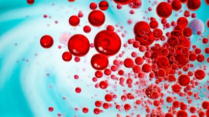 Sepsis Negligence Claims