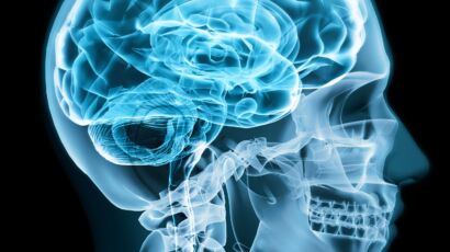 “Zakir” now 8 Case Study